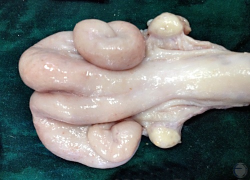 Normal Anestrous Uterus.