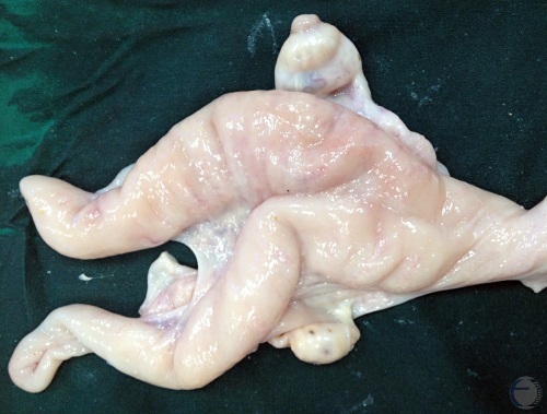 Normal Diestrous Uterus.