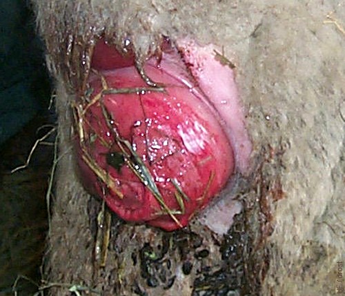 Vaginal Prolapse.