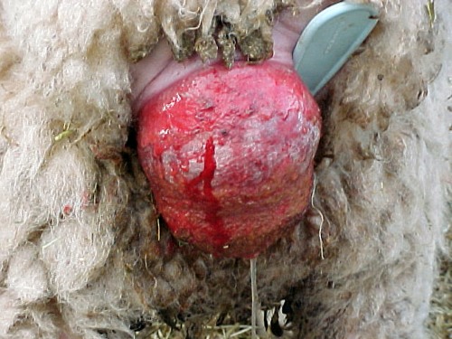 Recurrent Prolapse of the Vagina.