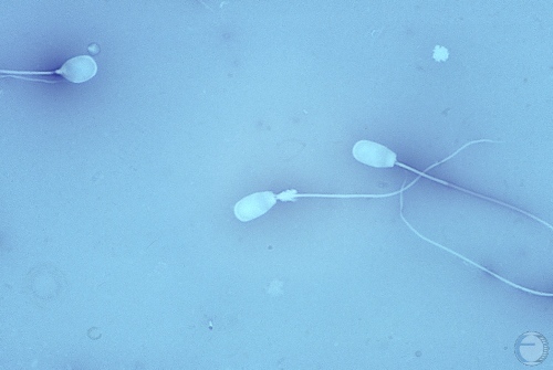 Semen Morphology: Protoplasmic Droplet.
