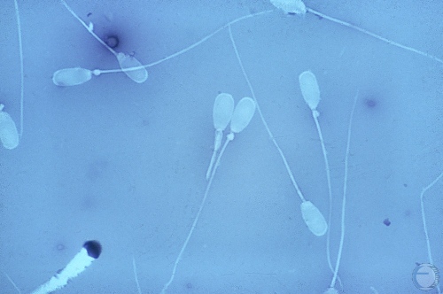 Semen Morphology: Protoplasmic Droplets.