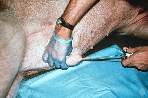 Extraction of the Penis.
