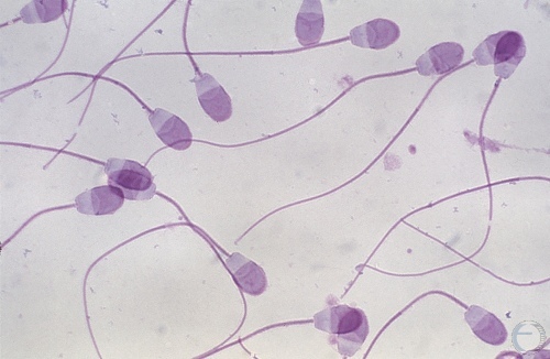 Semen Morphology: Normal Spermatozoa.