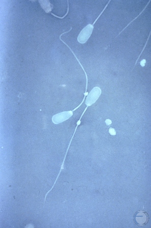 Semen Morphology: Protoplasmic Droplet.
