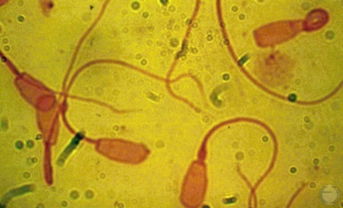 Spermatozoa.