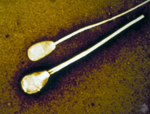 Double Midpiece of Spermatozoa.