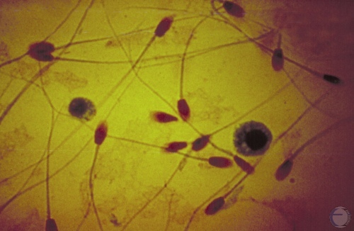 Spermatozoa and Neutrophils.