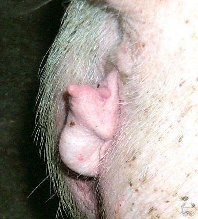 Intersex Vulva - Lateral View.