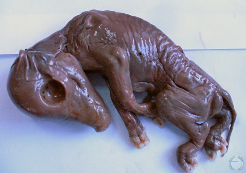 Mummified Fetus.