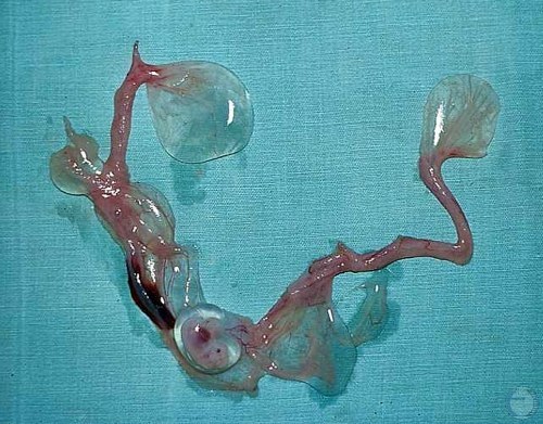24 Day Embryo.
