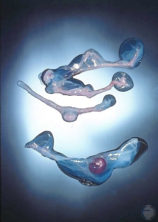 Degenerating Embryos.