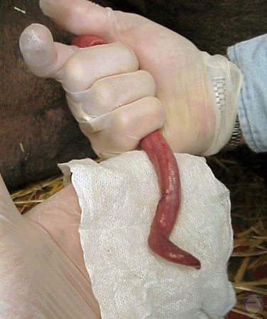 Penile Hypoplasia.