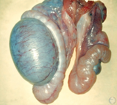 Testicular Hypoplasia.