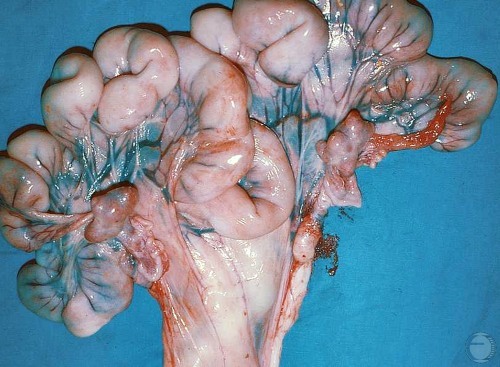 Diestrous Uterus.