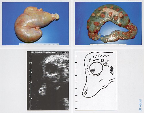Day 105 Fetal Head / Ultrasound.