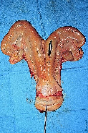 Colocación no-Quirúrgica del Embrión.