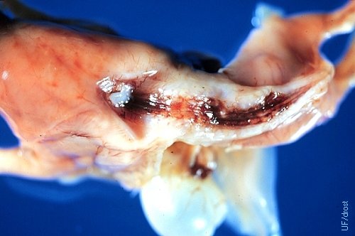 Columna vertebral de un feto con Schistosoma Reflexum.