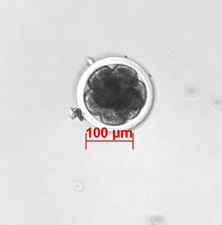 IVF 8-cell Embryo.