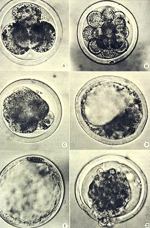 Fotos de Embriones.