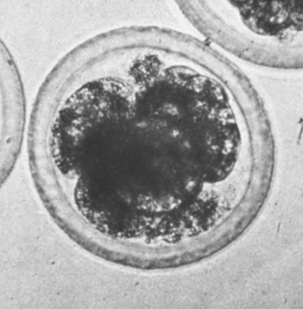 Embrión de 4 Células.