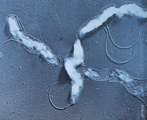 Campylobacter Fetus Subespecie Fetus.