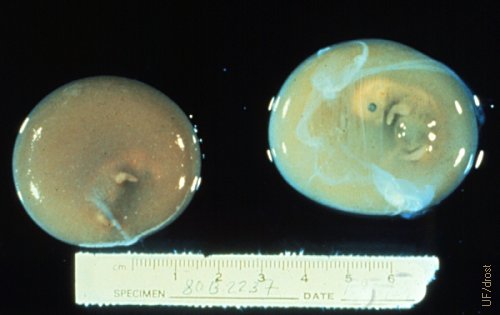 Mortalidad Embrionaria.