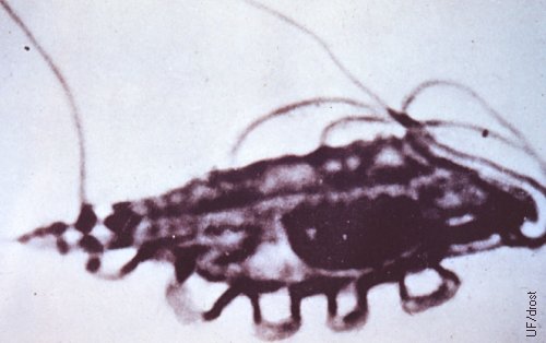 Organismos Tritrichomonas Foetus.