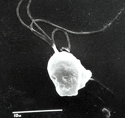 Microfotografía Electrónica de Barrido de T Foetus.