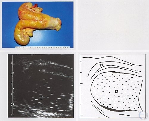 Ultrasonography of Pyometra.